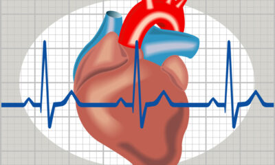 Aritmie cardiache nei giovani: sfide e speranze della terapia genica
