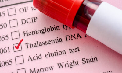 Talassemia: la malattia ereditaria dell'emoglobina