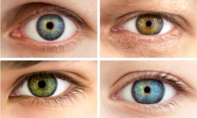 Cheratopigmentazione: la nuova procedura per cambiare il colore degli occhi