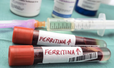 Ferritina nel sangue: cos'è e perchè si misura