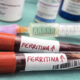 Ferritina nel sangue: cos'è e perchè si misura