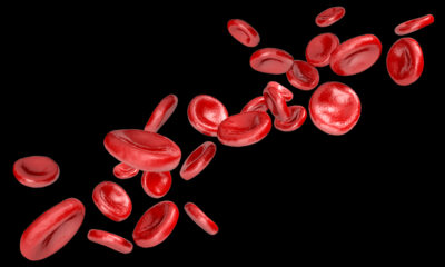 Macrocitosi: cos'è e come interpretare gli esami del sangue